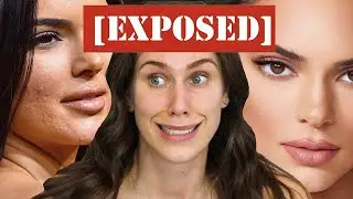 So today I decided to wake up and expose  celebrity acne & photoshop