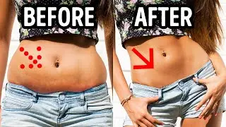 Start Eating 1 Orange a Day, See What Happens to Your Body
