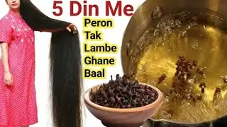 Diy Homemade Miracle Cloves Remedy For Extreme Fast Double Thicker Hair Growth 😍