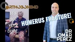 That's not funny! (Humerus Fracture Care)