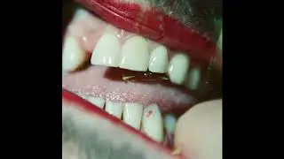 SAL&Ograve;  - Ohne Leine