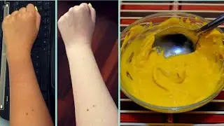 How to remove tan from face | tan removal home remedy