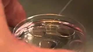 Invitro Fertilization (IVF) treatment in India by Forerunners-healthcare