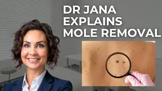 Dr Jana Torres-Grau - Mole Removal Treatments in London