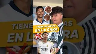 😱 &iquest;Que le ha pasado a Jude Bellingham? Mira el video y ent&eacute;rate‼️ #futbol #shorts #football #soccer