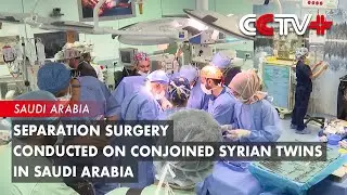 Separation Surgery Conducted on Conjoined Syrian Twins in Saudi Arabia
