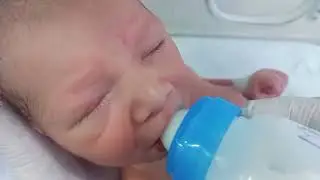 Little Baby with Poor Suck | Feeding Trial Under Observation | NICU Care Journey📝 