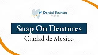 Snap On Dentures Dental Implants Ciudad de Mexico