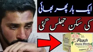 Skin Bleaching Gone Wrong | Soft Touch Peach Creme Bleach Review | Bleach Reaction