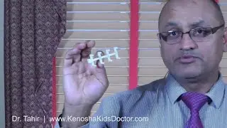 Needle Free Allergy Testing For Kids