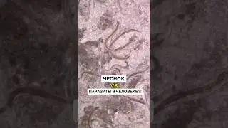 Чеснок против паразитов в организме Чеснок 2025