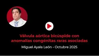 Válvula aórtica bicúspide con anomalías congénitas raras asociadas - Miguel Ayala León