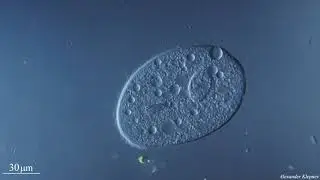 Great ciliate (Trithigmostoma)