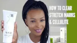 HOW TO REDUCE STRETCH MARKS & CELLULITE | SLIM R | Temiblogtv