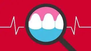 Smile Brighter, Live Better: Embrace the Benefits of Good Oral Care! (Tooth Pain)