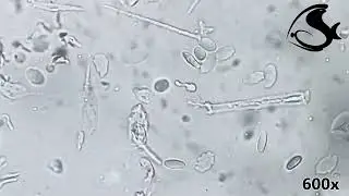 Ichthyobodo necator