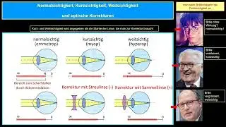 Mehr Wissen: Das Rätsel der Kurzsichtigkeit