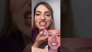 Does Hismile tooth gloss really work?🦷 Dentist tried tooth gloss #cosmeticdentistry