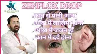 💊💊zenflox eye/ear drop uses , benefits, side effects💊💊