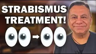 Treating Your Strabismus - Dr. Motwani Explains