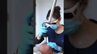Melasma treatment with pico laser #picolaser #picosurelaser #melasmatreatment #hyperpigmentation