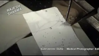 Conduit preparation by Dr. Rajesh Sharma.