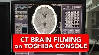 Протокол съемки КТ головного мозга на консоли Toshiba 16 Slice на английском языке.
