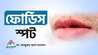 Fordyce Spots on Lips Treatment Bangla | ঠোঁটের সমস্যা ফোর্ডাইস স্পট | Lip Problem Solution Bangla