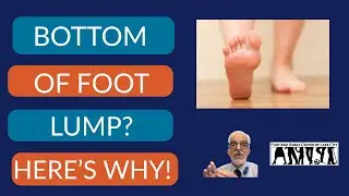 8 Reasons for that Lump On the Bottom of Your Foot