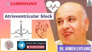 What is AV Block? Dr. Armen explains