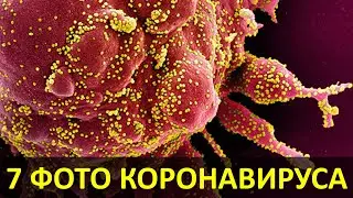 КОРОНАВИРУС ПОД МИКРОСКОПОМ | 7 ПОТРЯСАЮЩИХ ФОТО
