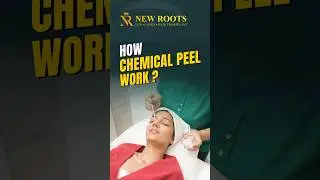 Chemical Peel Magic | Best Treatment for Glowing Skin 🛡️ #shorts