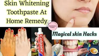 skin whitening magical hack using toothpaste  (PIMPLE )(DARK SPOT)( WHITENING Teeth ) brilliant hack