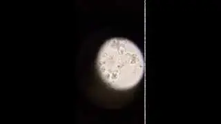 Bacteria eating platterful mushroom spores