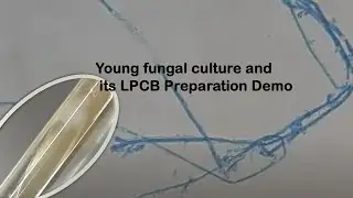 Young fungal culture and its LPCB Preparation