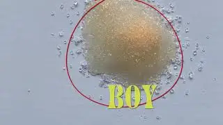 baby gender test with sugar gender test at home