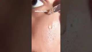 salah satu serum favorite Michelle nih yaitu Serum Ultra Hydrating, kalian wajib cobain sih 🥰
