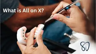Transform Your Smile with the All-on-X Procedure SmilePro Dental Stockton