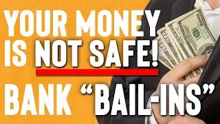 Your Bank Contract Terms That You Didnt Read It Will Destroy You!!!