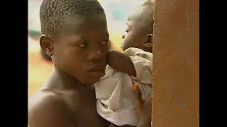 Sierra Leone War Amputees