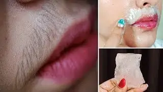 মাত্র ৪ মিনিটে সমস্ত অবাঞ্ছিত লোম দূর করুন সারাজীবনের জন্য । Permanent Hair Removal Hacks