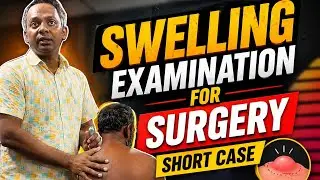 Swelling Examination Demonstration by Dr Murad Sir| Surgery Short Case | Final Prof Examination