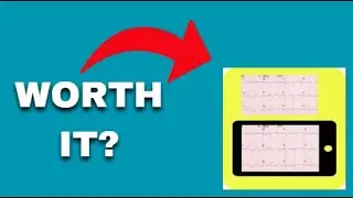 ECG Reader App Review
