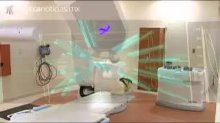 CyberKnife, sistema robótico contra el cáncer