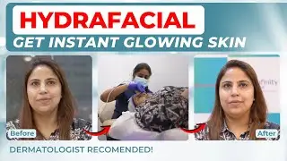 Hydra Facial Treatment Review | Before & After Results!