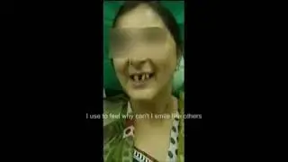 Full Mouth Implant fixed teeth in 3 days in mumbai - Patient Video Testimonial Call- +918308411139