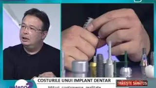 Costurile unui implant dentar.mp4