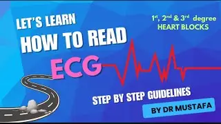 How to read ECG? - Part 2 l HEART BLOCKS explained for junior doctors 