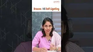 Difference Between Braces vs Self-Ligating Braces | #shorts #telugushorts #braces #selfligating