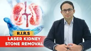 Laser Kidney Stone Removal - RIRS | Dr. Nitin Negi - Urologist in Jaipur